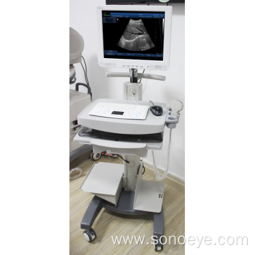 Trolley type ultrasound machine for clinic